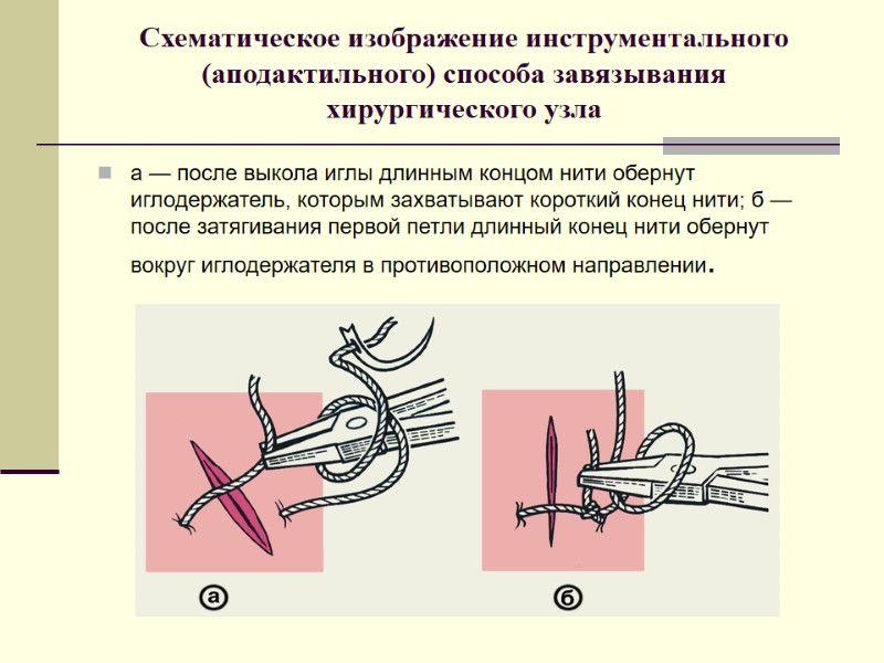 Схематическое изображение инструментального (аподактильного) способа завязывания хирургического узла  а — после выкола иглы
